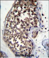 IHC-P - FBXO15 Antibody (N-term) AP12418a