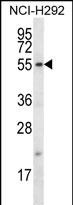 WB - FBXO15 Antibody (N-term) AP12418a
