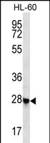 WB - CL052 Antibody (N-term) AP12423A