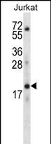 WB - KRTAP13-3 Antibody (C-term) AP12430b