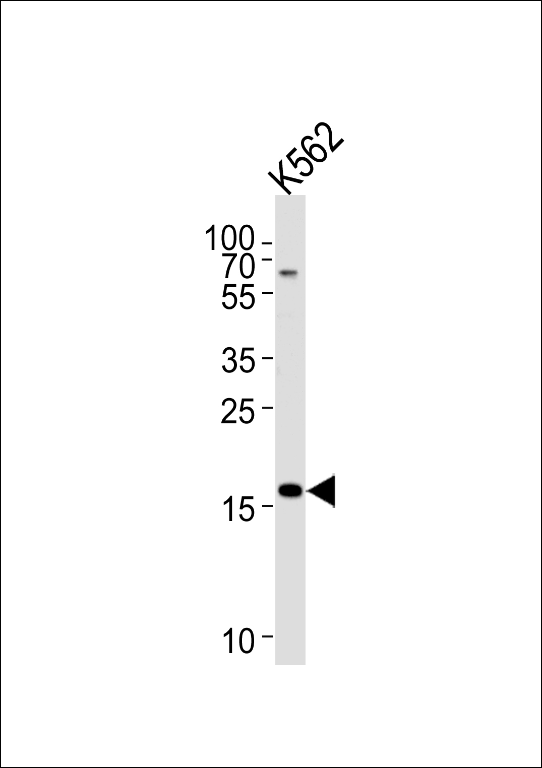 WB - RNF5 Antibody (Center) AP12440c