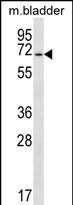 WB - EYA1 Antibody (N-term) AP12446a