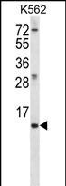 WB - MEIG1 Antibody (Center) AP12447C