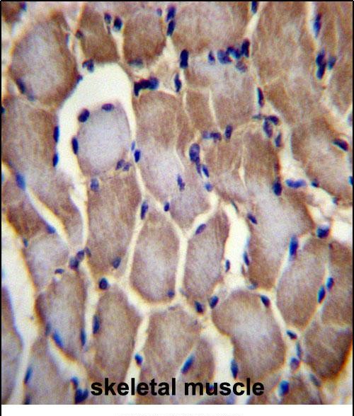 IHC-P - SEPN1 Antibody (C-term) AP12452B