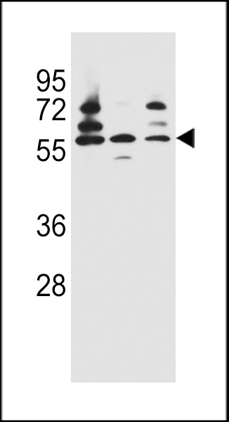 PDP1 Antibody (Center) (Cat. #AP12453c) western blot analysis in Jurkat,HepG2,293 cell line lysates (35ug/lane).This demonstrates the PDP1 antibody detected the PDP1 protein (arrow).