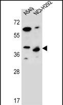 WB - LRRC67 Antibody (C-term) AP12456b