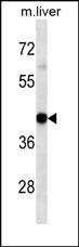 WB - HLA-A Antibody(Center) AM1843b