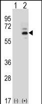 WB - FASTK Antibody (C-term) AP12464b