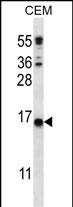 WB - CJ057 Antibody (C-term) AP12475b