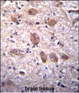 IHC-P - SPG7 Antibody (Center) AP12476c