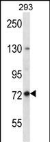WB - SPG7 Antibody (Center) AP12476c