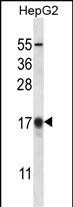 APG8b(MAP1LC3B) Antibody (T29) (Cat. #AP12484a) western blot analysis in HepG2 cell line lysates (35ug/lane).This demonstrates the APG8b(MAP1LC3B) antibody detected the APG8b(MAP1LC3B) protein (arrow).