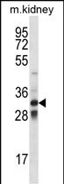 WB - TLX1 Antibody (Center) AP12489c