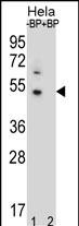 Western blot analysis of DNAJB6 Antibody (Center) Pab (Cat. #AP12493c) pre-incubated without(lane 1) and with(lane 2) blocking peptide in Hela cell line lysate. DNAJB6 Antibody (Center) (arrow) was detected using the purified Pab.
