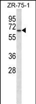 GPD2 Antibody (C-term) (Cat. #AP12502b) western blot analysis in ZR-75-1 cell line lysates (35ug/lane).This demonstrates the GPD2 antibody detected the GPD2 protein (arrow).