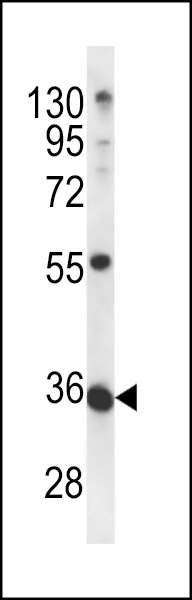 WB - METTL11B Antibody (N-term) AP12508a