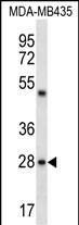 WB - CDRT15L2 Antibody (C-term) AP12513b