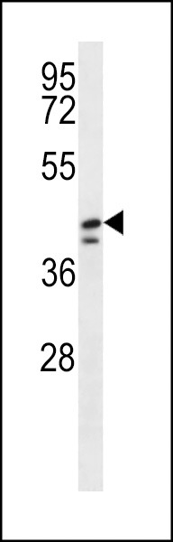 WB - DUS1L Antibody (C-term) AP12520b