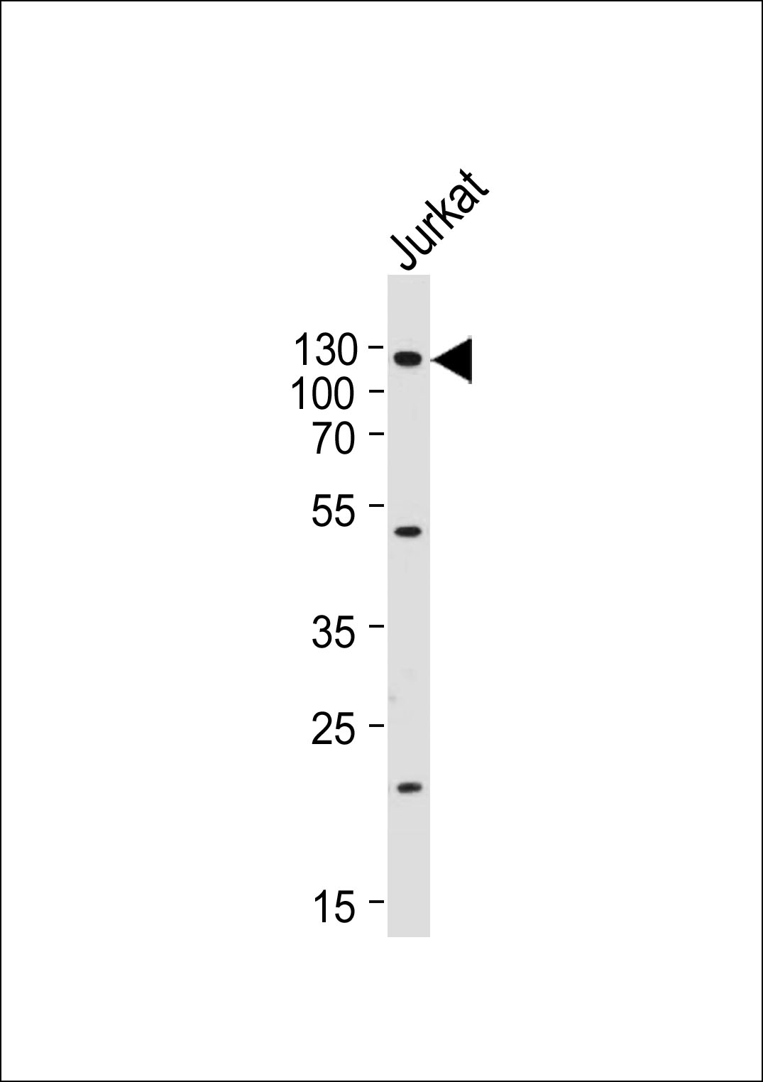 Western blot analysis of lysate from Jurkat cell line,  using GAA Antibody (N-term)(Cat.  #AP12544a). AP12544a was diluted at 1:2000.  A goat anti-rabbit IgG H&L(HRP) at 1:10000 dilution was used as the secondary antibody. Lysate at 20ug.