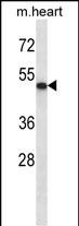 ABI2 Antibody (N-term) (Cat. #AP12566a) western blot analysis in mouse heart tissue lysates (35ug/lane).This demonstrates the ABI2 antibody detected the ABI2 protein (arrow).