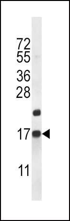 WB - CARTPT Antibody (N-term) AP12574A