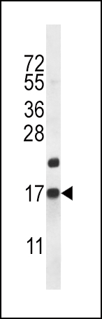 CARTPT Antibody (N-term) (Cat. #AP12574a) western blot analysis in mouse heart tissue lysates (35ug/lane).This demonstrates the CARTPT antibody detected the CARTPT protein (arrow).