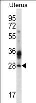 WB - CIB4 Antibody (N-term) AP12591a
