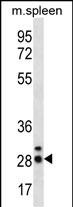 WB - CIB4 Antibody (N-term) AP12591a