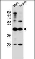 WB - ACSM6 Antibody (C-term) AP12601b