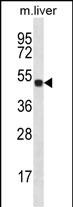 HOXD10 Antibody (C-term) (Cat. #AP12608b) western blot analysis in mouse liver tissue lysates (35ug/lane).This demonstrates the HOXD10 antibody detected the HOXD10 protein (arrow).