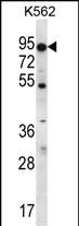ABCD2 Antibody (C-term) (Cat. #AP12623b) western blot analysis in K562 cell line lysates (35ug/lane).This demonstrates the ABCD2 antibody detected the ABCD2 protein (arrow).