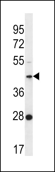 WB - F105A Antibody (Center) AP12625C