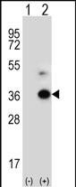 Western blot analysis of ANGPTL7 (arrow) using rabbit polyclonal ANGPTL7 Antibody (C-term) (Cat. #AP12644b). 293 cell lysates (2 ug/lane) either nontransfected (Lane 1) or transiently transfected (Lane 2) with the ANGPTL7 gene.