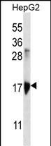 WB - KRTAP1-3 Antibody (Center) AP12654c