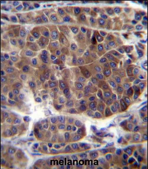 IHC-P - PRAMEF3 Antibody (C-term) AP12658b