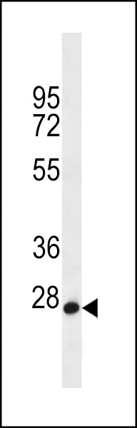 WB - MED22 Antibody (N-term) AP12666a