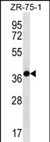 WB - TNMD Antibody (Center) AP12668c