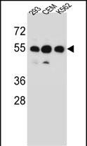 WB - ZNF562 Antibody (N-term) AP12672a