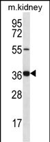 WB - GRXCR1 Antibody (Center) AP12687c