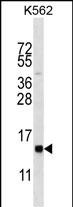 WB - HIST1H2BL Antibody (N-term) AP12710a