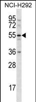 WB - CLEC18A Antibody (C-term) AP12716b