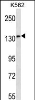 MN1 Antibody (Center) (Cat. #AP12722c) western blot analysis in K562 cell line lysates (35ug/lane).This demonstrates the MN1 antibody detected the MN1 protein (arrow).