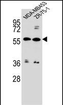 WB - ABCG4 Antibody (N-term) AP12723A