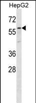 ZP4 Antibody (C-term) (Cat. #AP12724b) western blot analysis in HepG2 cell line lysates (35ug/lane).This demonstrates the ZP4 antibody detected the ZP4 protein (arrow).