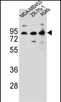 CTTNBP2NL Antibody (N-term) (Cat. #AP12725a) western blot analysis in MDA-MB453,ZR-75-1,A549 cell line lysates (35ug/lane).This demonstrates the CTTNBP2NL antibody detected the CTTNBP2NL protein (arrow).