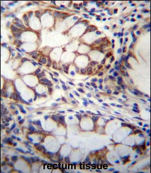 IHC-P - GPSM1 Antibody (Center) AP12738c