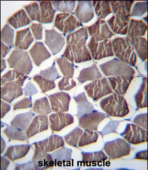 IHC-P - NPHP3 Antibody (N-term) AP12751a
