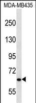 WB - NPHP3 Antibody (N-term) AP12751a