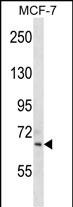 SIGLEC11 Antibody (Cat. #AP1629b) western blot analysis in MCF-7 cell line lysates (35ug/lane).This demonstrates the SIGLEC11 antibody detected the SIGLEC11 protein (arrow).