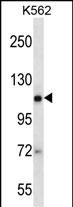 EIF2C2 Antibody (N-term Q41) (Cat. #AP1903a) western blot analysis in K562 cell line lysates (35ug/lane).This demonstrates the EIF2C2 antibody detected the EIF2C2 protein (arrow).